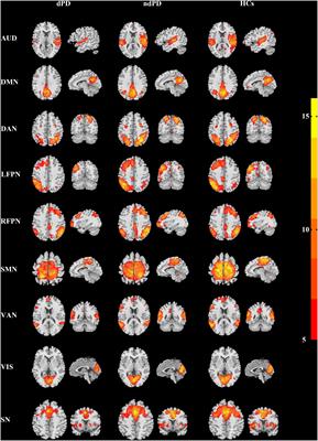 Altered Neural Network Connectivity Predicts Depression in de novo Parkinson’s Disease